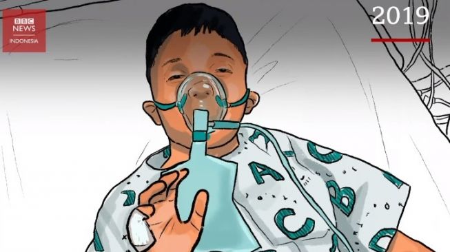 Korban Gas Beracun di Malaysia:  Trauma Psikologis dan Kejang Otot Berulang