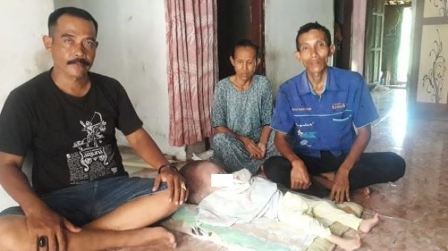 Kondisi Bayi Pengidap Hidrosefalus Ini Bikin Iba