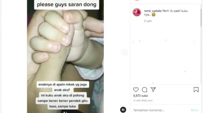 Viral Pengasuh Potong Kuku Bayi hingga Luka dan Kesakitan