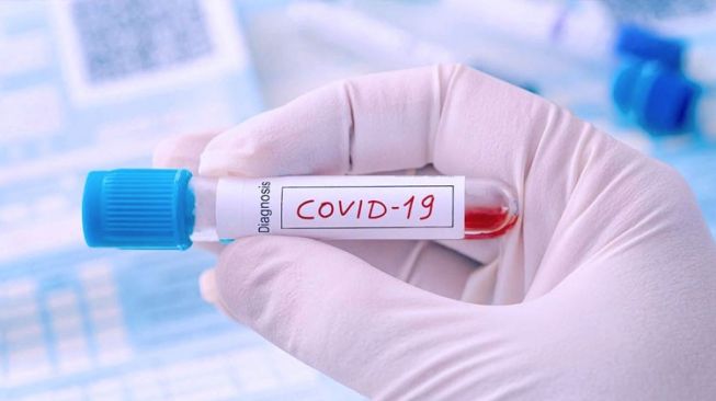 Ini Empat Penyebab Melonjaknya Kasus Covid-19 di Kota Malang