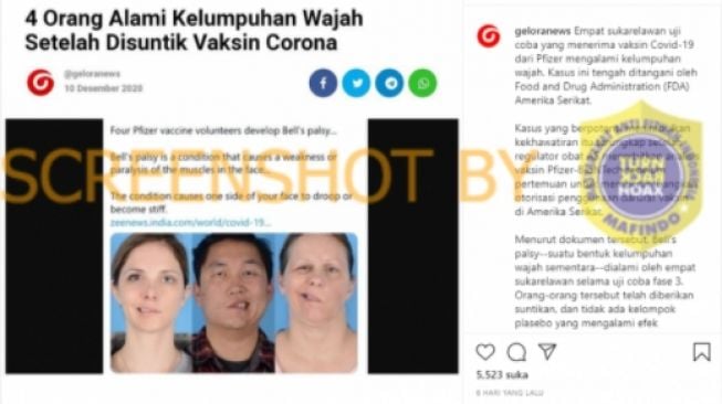 CEK FAKTA: Benarkah 4 Orang Ini Lumpuh Wajah Usai Suntik Vaksin Corona?