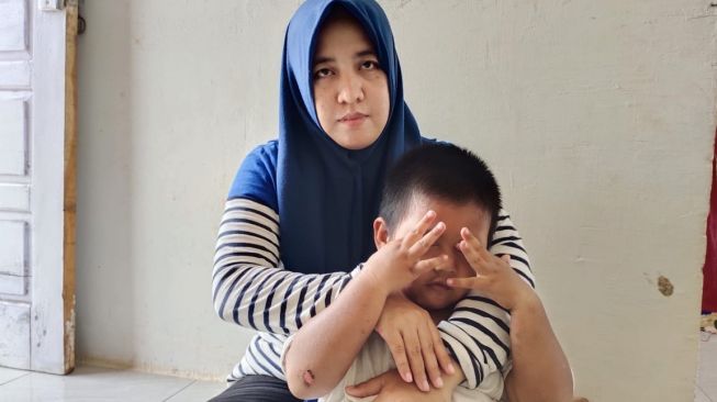 Anak Dipukul Tetangga Gegara Tanaman Hias, Anisa Terus Perjuangkan Kasusnya
