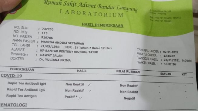 Surat hasil pemeriksaan antigen Andika Mahesa alias Andika eks Kangen Band. [istimewa]