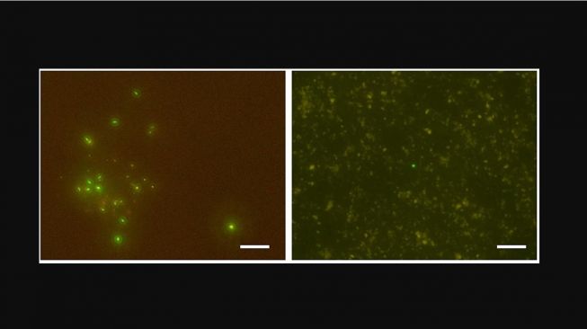 Mikroorganisme bersel tunggal hidup di laut bersuhu 120 derajat. [Scitechdaily]