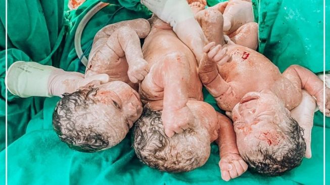 Bayi kembar tiga atau triplets. (Facebook/Hospital Maternidade Marieta Konder Bornhausen)