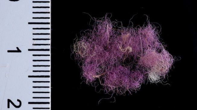 Kain Ungu Berusia 3.000 Tahun Diduga Dipakai Raja Daud dan Sulaiman