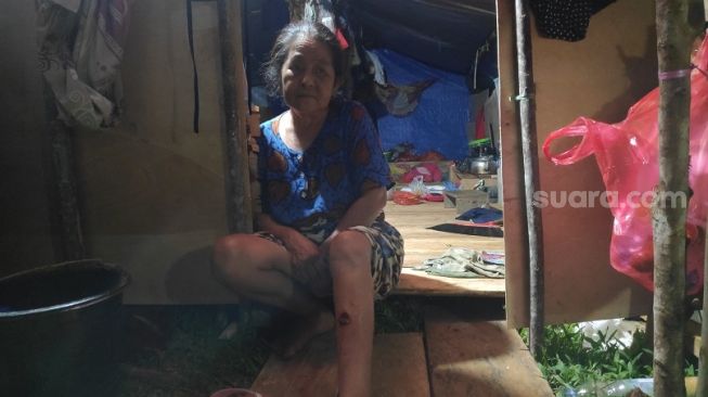 Kisah Nenek Juma Korban Gempa Sulbar, Susah Jalan Gegara Kaki Tertimpa Batu