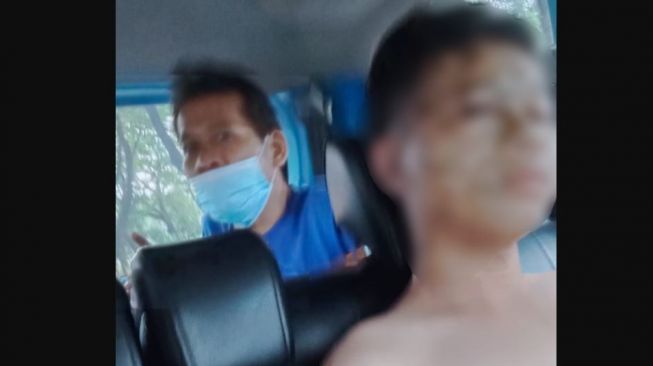 Korban Penyiraman Air Keras di Cipondoh Tangerang Lapor Polisi