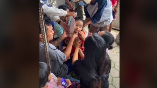 Viral Bocah Terlilit Kalung Besi, Sekampung Heboh Lepaskan Pakai Gergaji