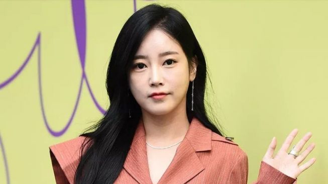 Diganggu Seorang Penguntit, Soyeon T-Ara Dapat Ancaman Pembunuhan