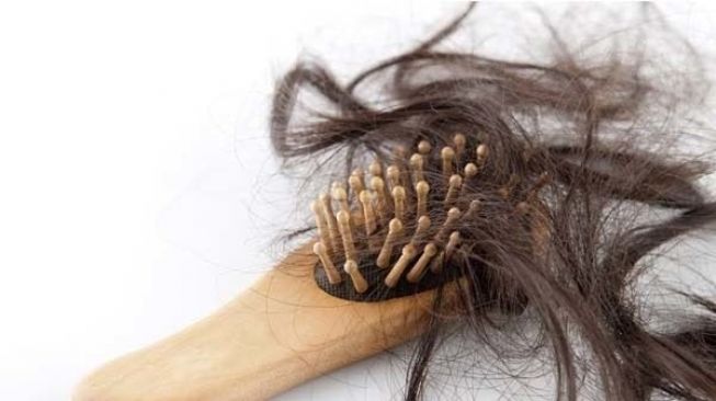 Curhat Wanita yang Kehilangan 80 Persen Rambut hingga Nyaris Botak, Sebut Hal Ini Jadi Penyebabnya