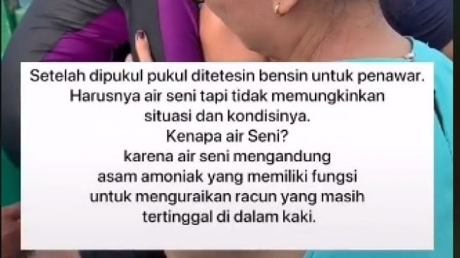 Pertolongan untuk korban terkena duri bulu babi (tiktok)