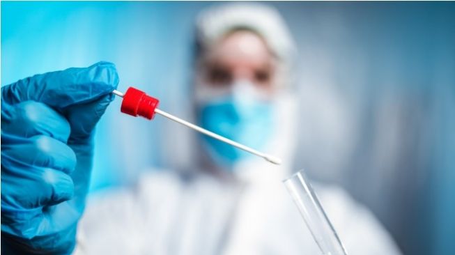 RSUD AW Syahrani Temukan Pasien Covid-19 Gunakan Surat Hasil PCR Palsu