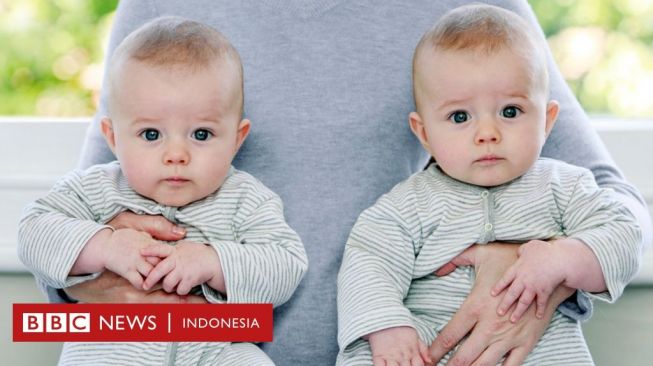 Akankah Jumlah Anak Kembar Semakin Berkurang di Masa Depan?