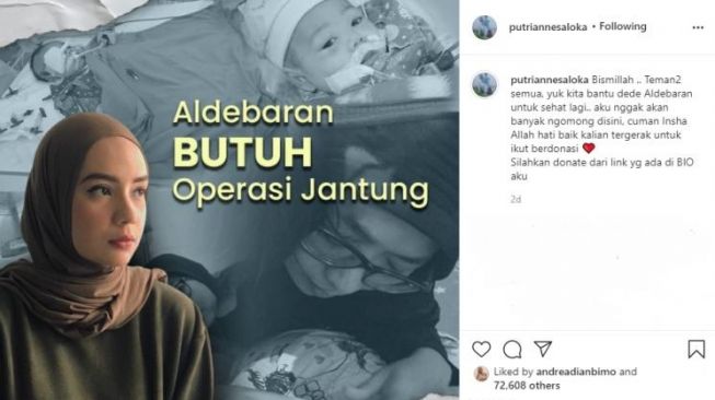 Istri Arya Saloka, Putri Anne galang donasi untuk bayi Aldebaran. [Instagram/putriannesaloka]