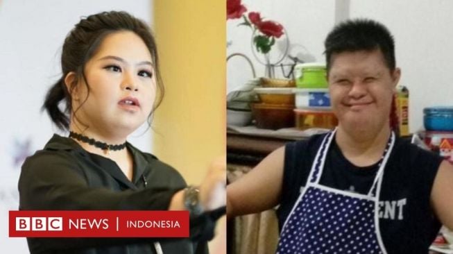 Hari Down Syndrome Internasional: Anak Saya Sudah Melampaui Harapannya