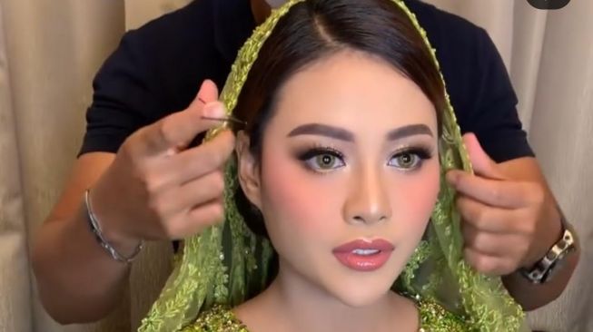 Gembar Gembor Mau Anak Kembar, Aurel Hermansyah Menderita Kista