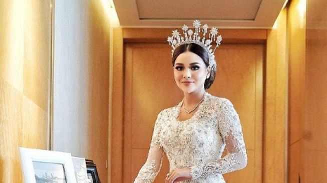 Aurel Hermansyah Punya Kista Ovarium, Perempuan Harus Waspada 10 Gejalanya