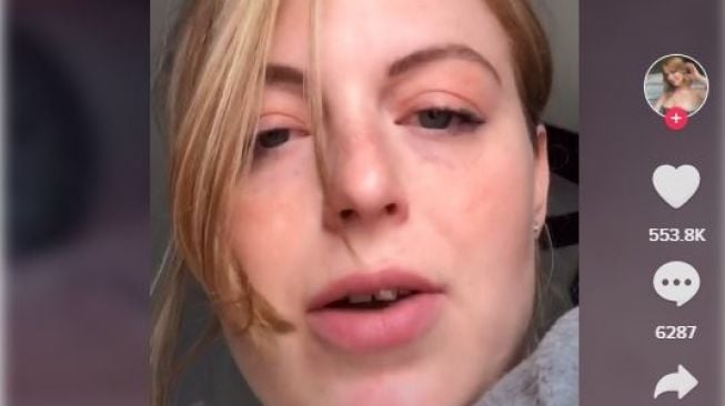 Brittany Jacobs, wanita yang baru menyadari punya dua vagina. (TikTok)