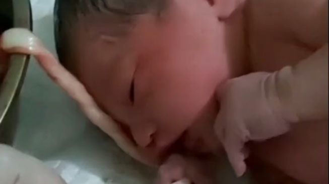 Viral Bayi Pegang Erat Tali Pusatnya Sesaat Setelah Dilahirkan, Gemes!