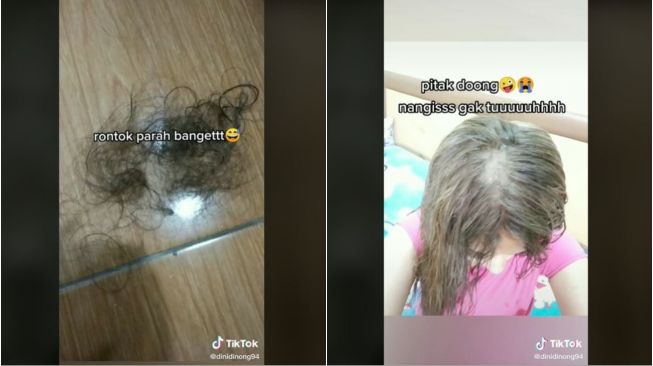 Salah Pilih Salon, Rambut Wanita Ini Berakhir Pitak Pasca Bleaching (tiktok.com/@jenongholl) 