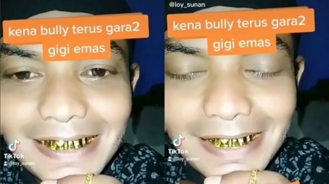 Viral! Semua Gigi Diganti Emas, Pria Ini Dibully Habis-Habisan