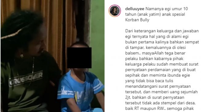 Bocah korban bully di Bogor. (Instagram/@delluyee)