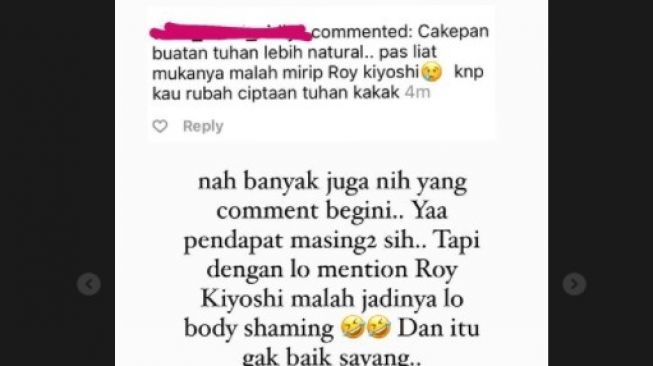 Ricky Cuaca dibilang mirip Roy Kyoshi usai oplas hidung. (Instagram/@rickycuaca)