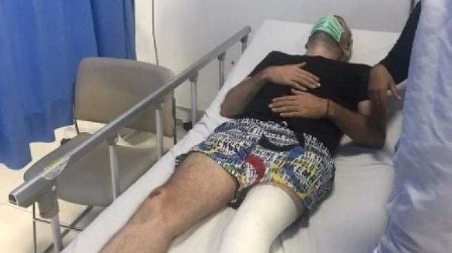 Federico (47), turis Italia digebuki sampai kaki patah di Jalan Camplung Tanduk No 200X, Seminyak, Kuta, Badung, Bali. (Denpasar.viral)