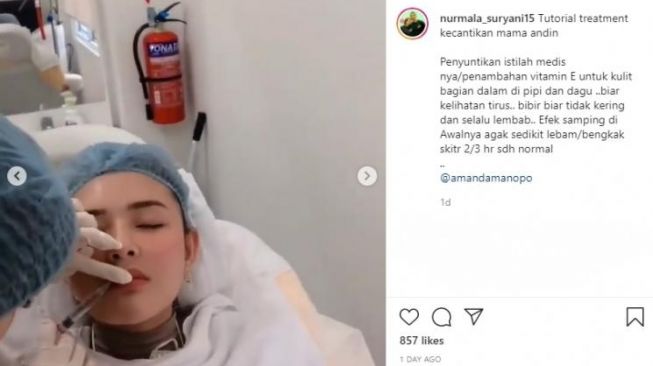 Perawatan yang dilakukan Amanda Manopo. (Instagram/nurmala_suryani15)