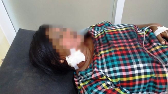 Sadis! Ditolak Berhubungan Intim, Warga Brebes Tusuk Leher Istri