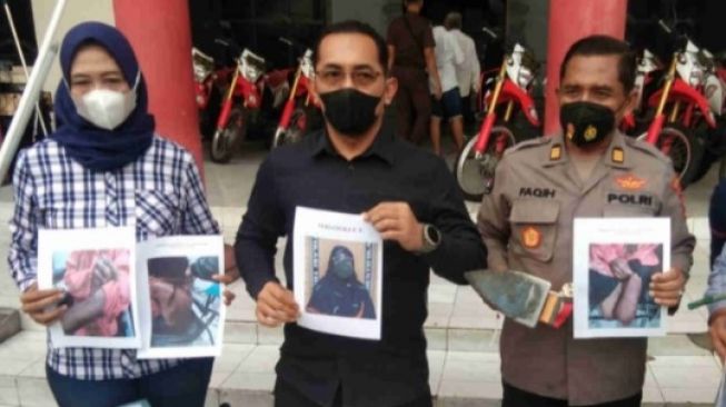 Perih, Majikan di Surabaya Setrika Tangan Asisten Rumah Tangga