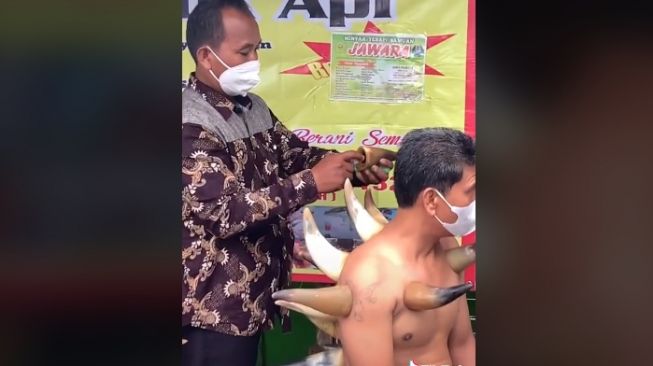 Viral Praktik Bekam Pakai Tanduk, Penampakan Pasien Bikin Wibu Bereaksi