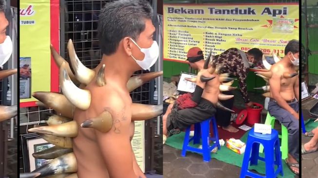 Heboh! Bekam Tanduk, Penampakan Pasien Bikin Warganet Ingat Sosok Ini