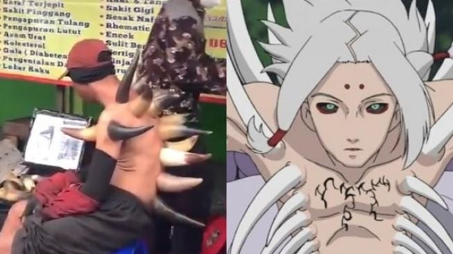 Viral Terapi Bekam Tanduk Api, Pasien Jadi Mirip Kimimaro di Film Naruto