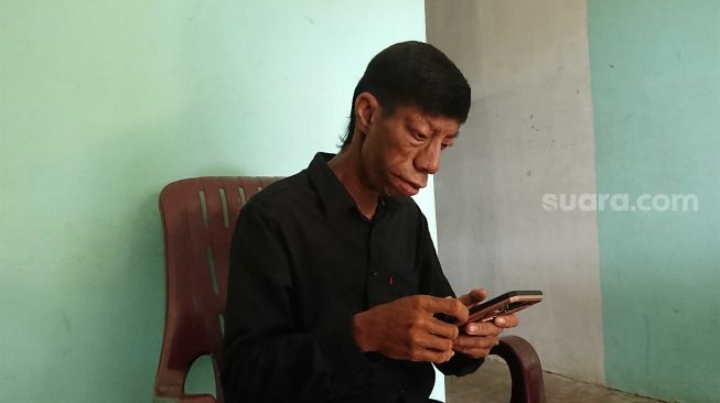 Videonya Viral Ditonton Puluhan Juta Warganet di Tiktok, Pria Ini Malah Nggak Bisa Tidur