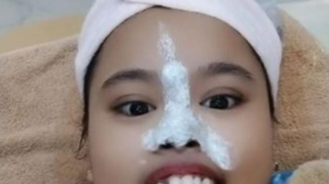 Potret penampilan Kekeyi usai filler hidung. (TikTok/kekeyi_23)