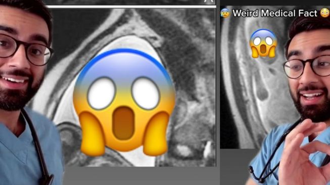 Dokter Bagikan Wujud Seram Janin Saat MRI, Kayak Monster!