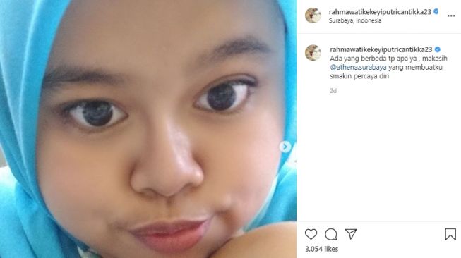 Potret penampilan Kekeyi usai filler hidung. (Instagram/rahmawatikekeyiputricantikka23)