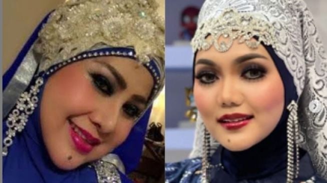 8 Potret Rina Nose Tirukan Gaya Artis Lain, Mirip Semua!