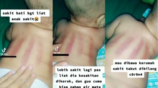 Viral Ibu Curhat Tak Tega Bayinya Dikerok Karena Sakit, Tuai Kritikan