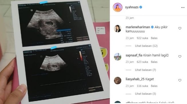 Syahnaz Sadiqah Pamer Foto Hasil Usg Hamil Lagi