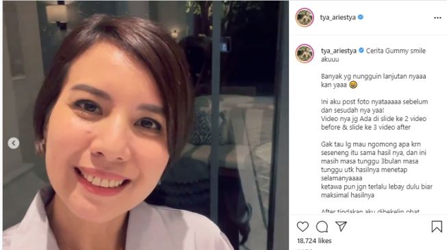 Potret Tya Arietya usai potong gusi. [Instagram/tya_ariestya]