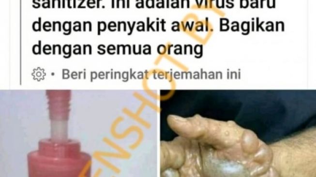 CEK FAKTA: Benarkah Handsanitizer Merek Ini Mengandung Virus Baru dan Buat Tangan Melepuh?