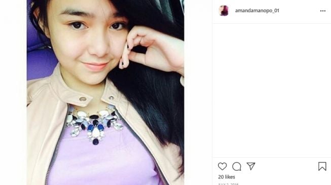 Amanda Manopo sebelum dan sesudah perawatan [Instagram]