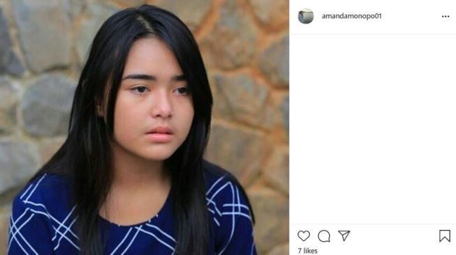 Amanda Manopo sebelum dan sesudah perawatan [Instagram]