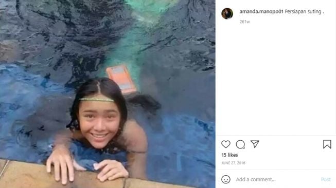 Amanda Manopo sebelum dan sesudah perawatan [Instagram]