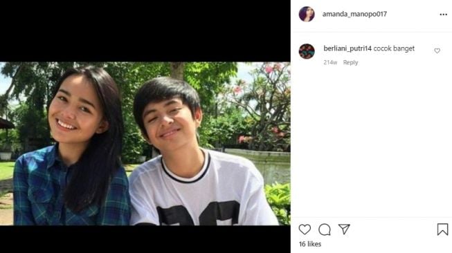 Amanda Manopo sebelum dan sesudah perawatan [Instagram]