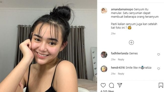 Amanda Manopo sebelum dan sesudah perawatan [Instagram]