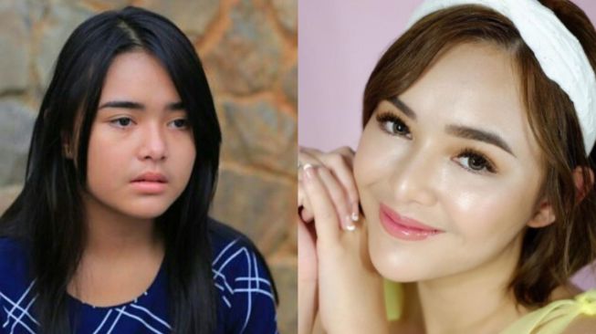 10 Potret Amanda Manopo Sebelum dan Sesudah Perawatan